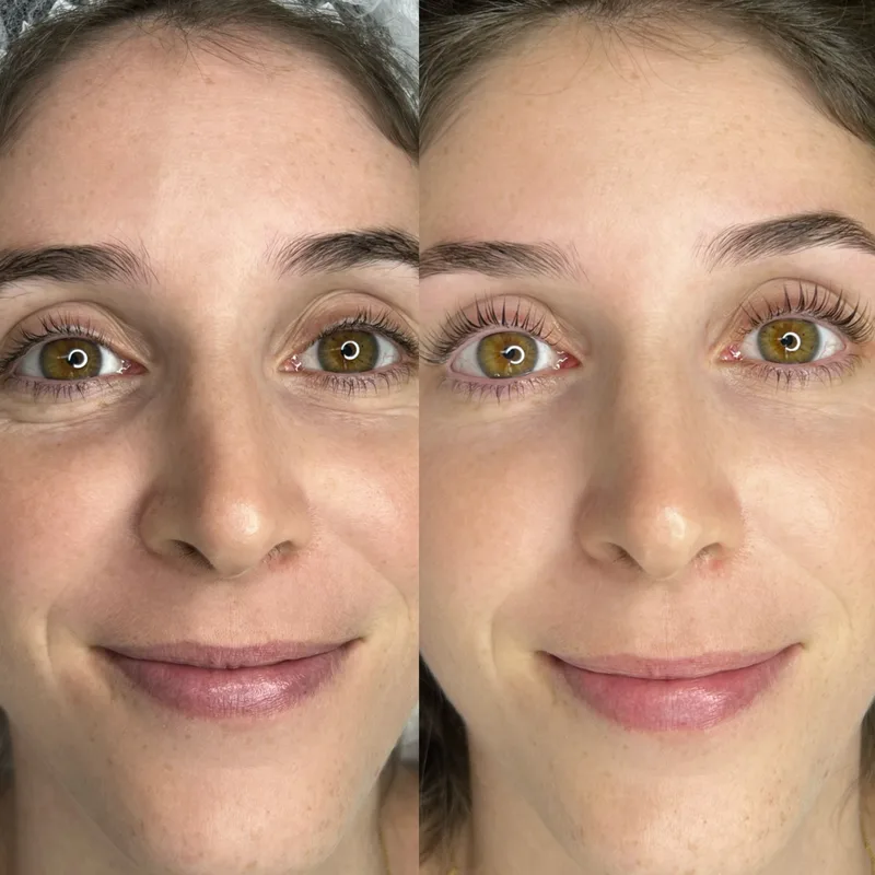 Before and after result of Lash Lift