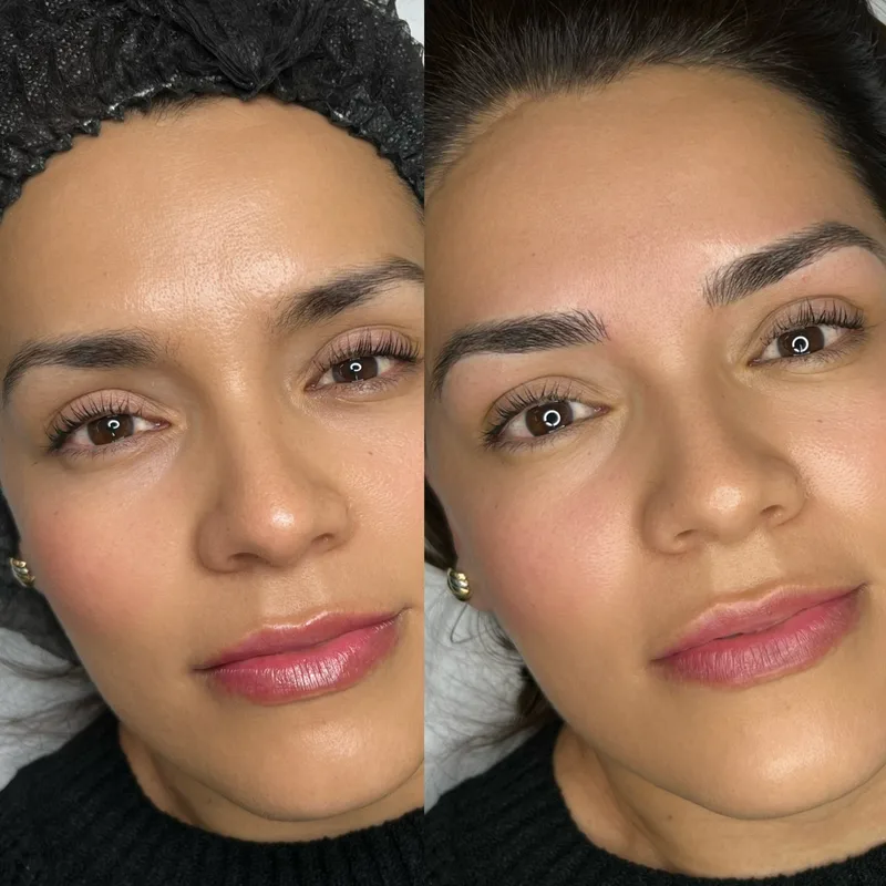 Before and after result of Signature Microblading
