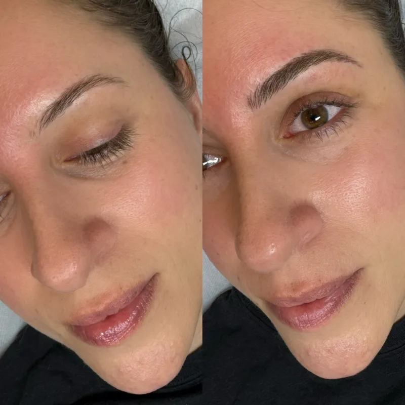 Before and after result of Signature Microblading