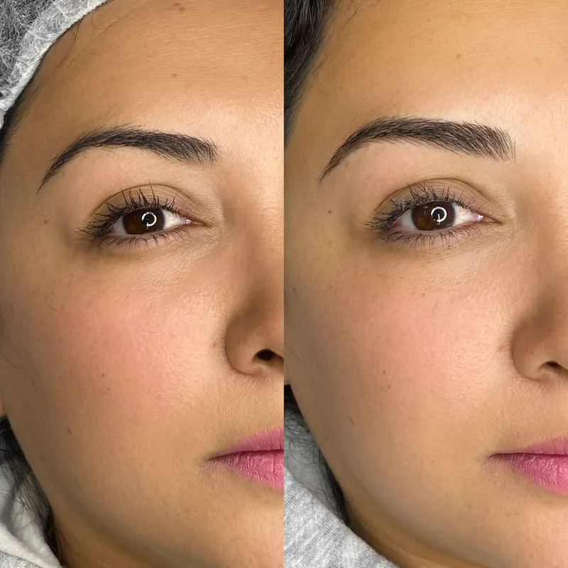 Before and after result of Signature Microblading