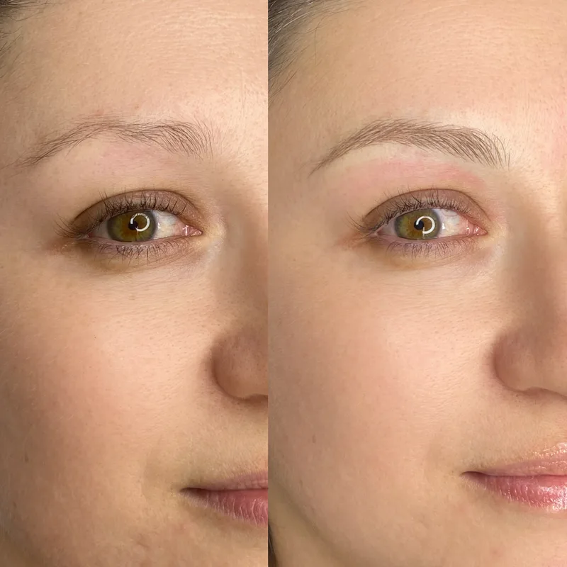 Before and after result of Signature Microblading