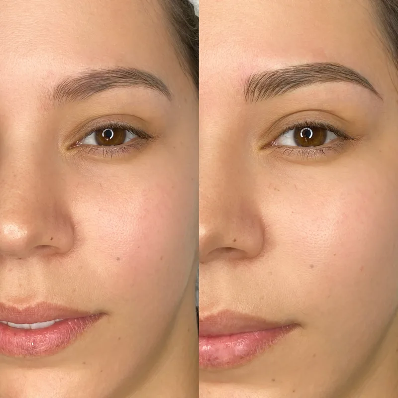 Before and after result of Signature Microblading