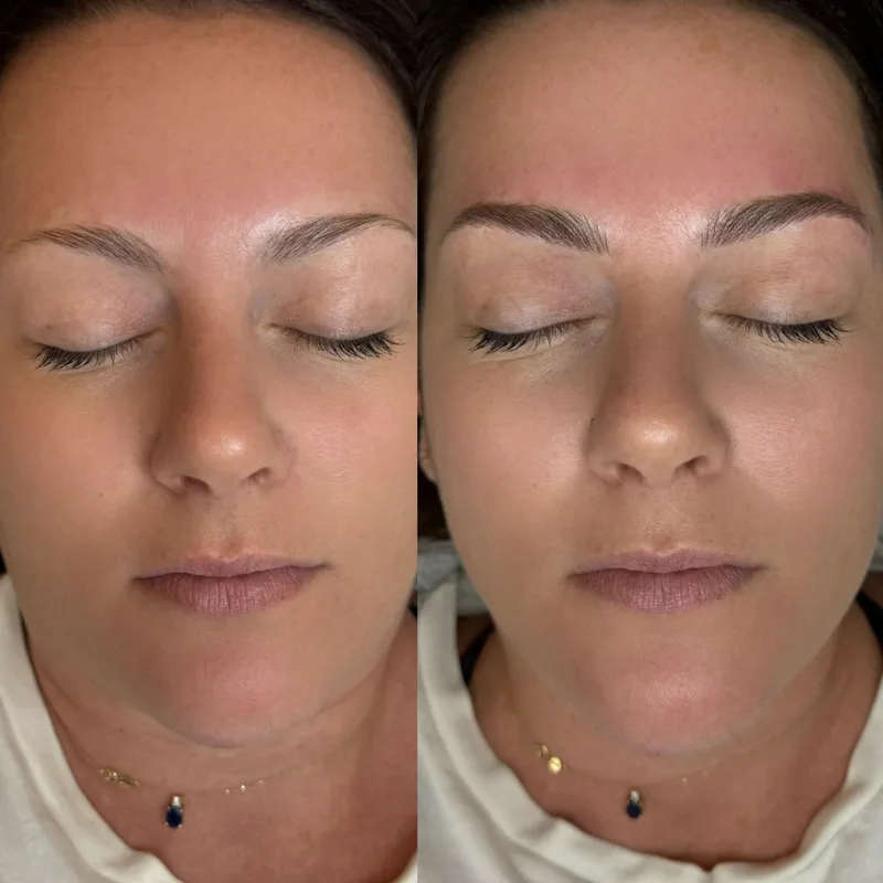 Before and after result of Signature Microblading