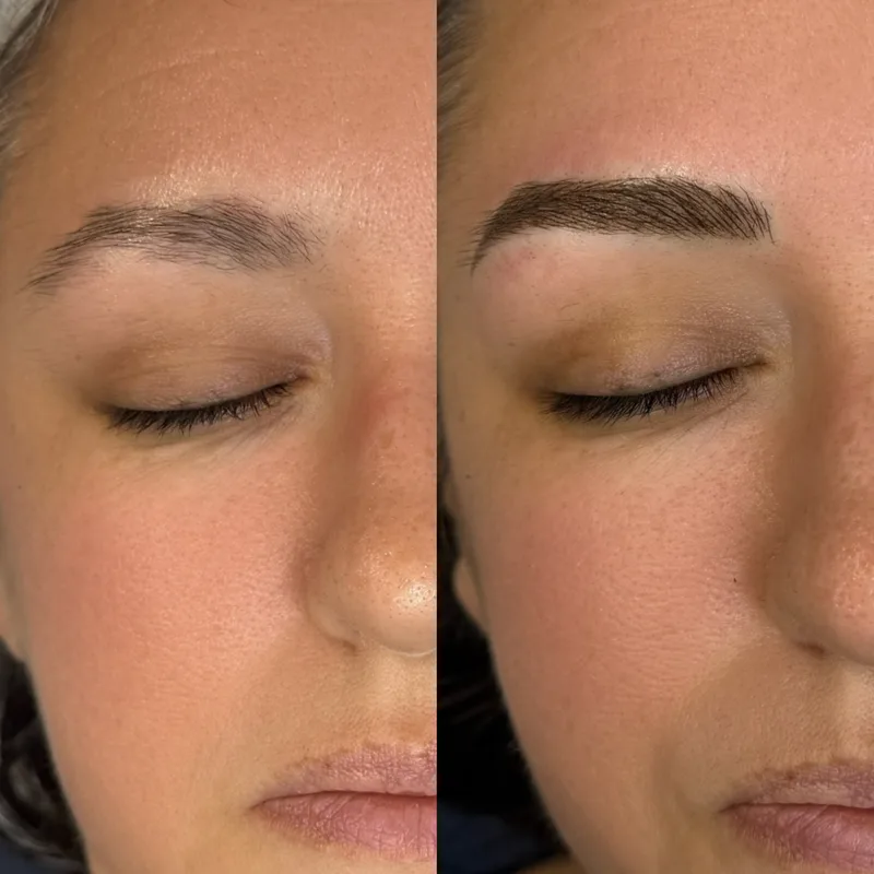 Before and after result of Signature Microblading
