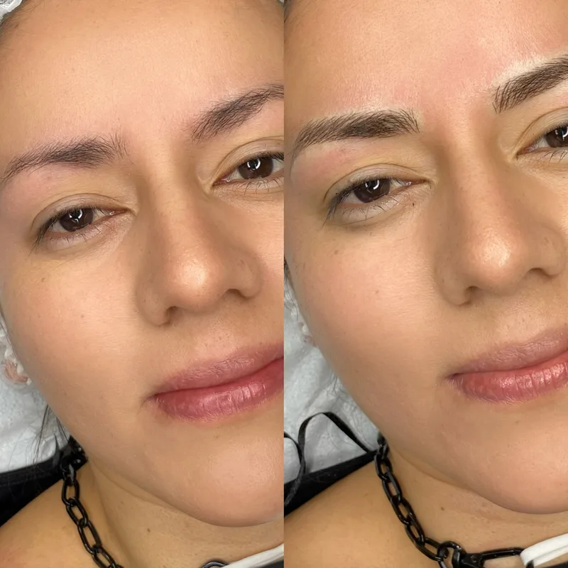 Before and after result of Signature Microblading