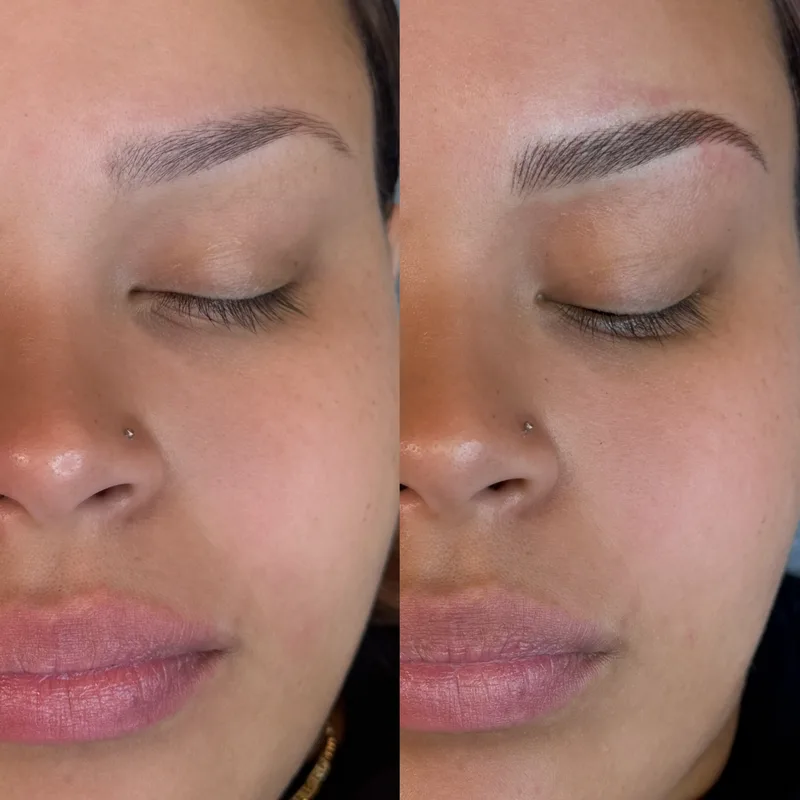 Before and after result of Advanced Nano Brows