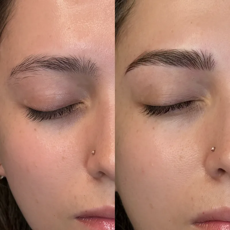 Before and after result of Advanced Nano Brows