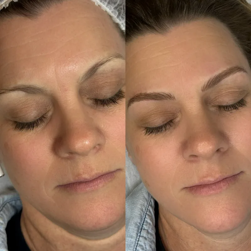 Before and after result of Advanced Nano Brows