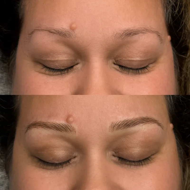 Before and after result of Advanced Nano Brows