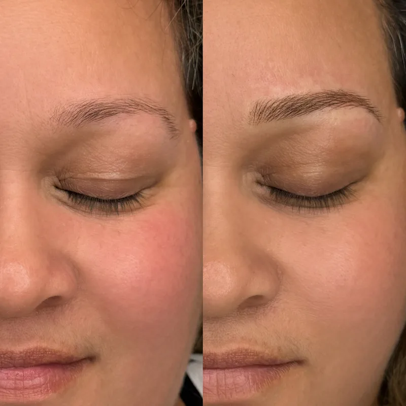 Before and after result of Advanced Nano Brows